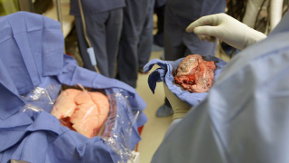 Illustration for article titled How a human lung is kept alive and breathing for a transplant
